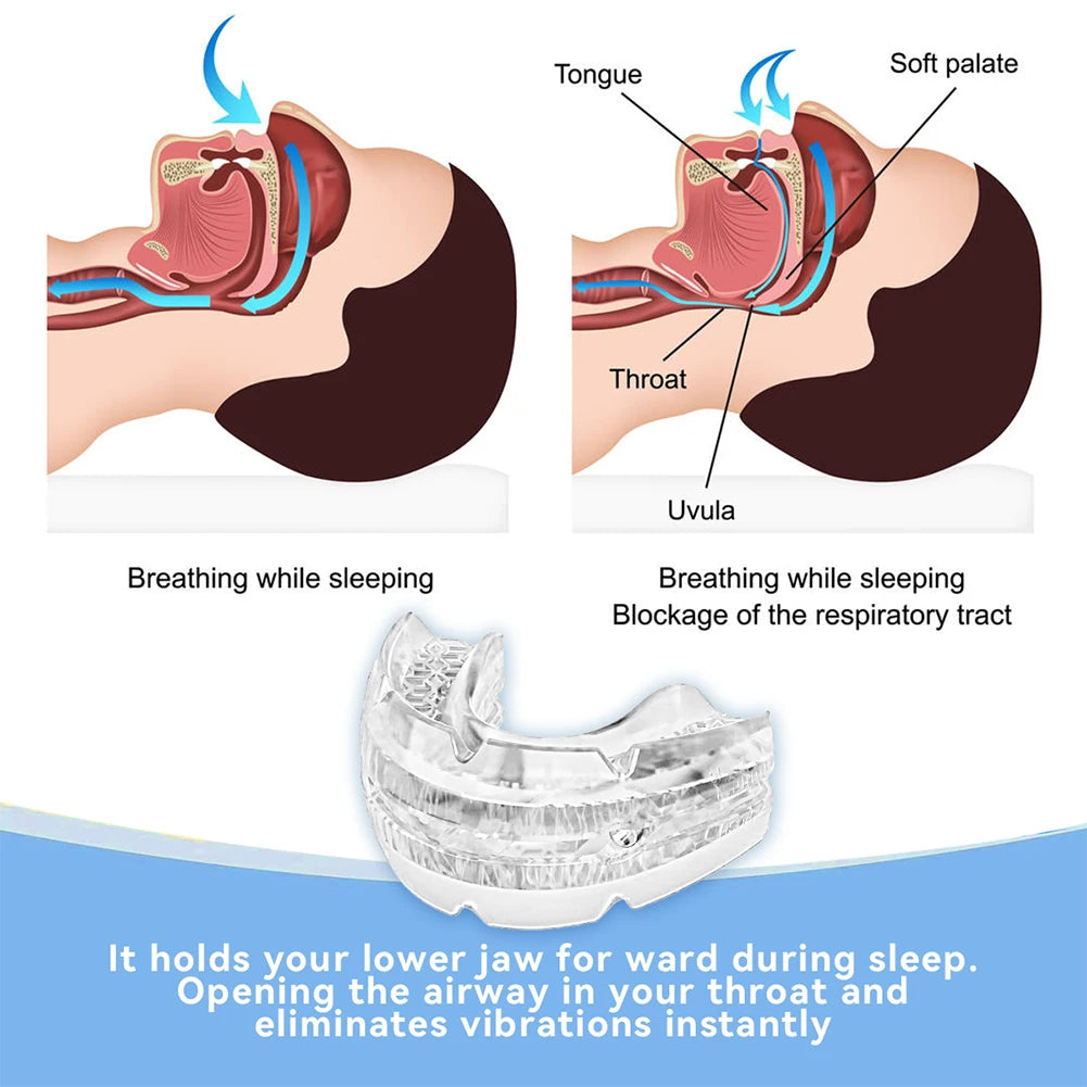 Snooze Guard Anti Snoring Mouthpiece | Adjustable, Eco-Friendly Design 1